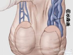 精索动脉曲张 吃瓜,揭秘“吃瓜群众”的隐秘困扰